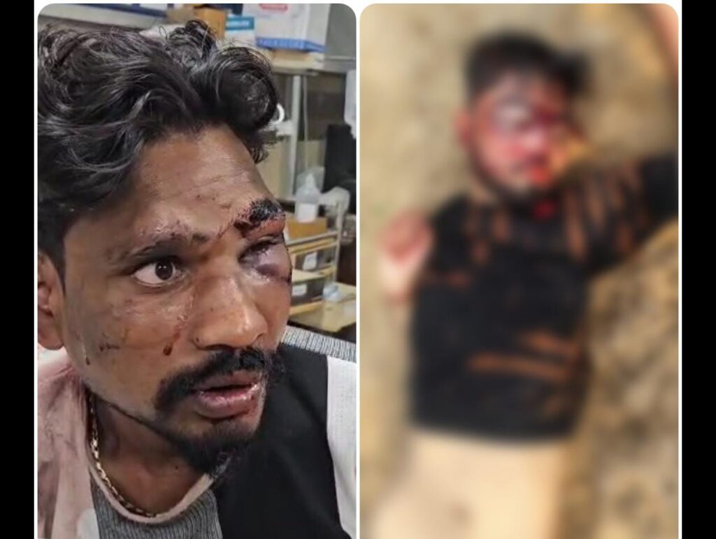 Crime News : ब्लैक में शराब लेने गए युवक को पीट-पीटकर कर मार डाला, एक गंभीर रूप से घायल... आरोपी फरार